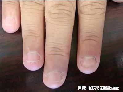 剪指甲、挖耳屎，这些日常小动作竟隐藏大危害！ - 肇庆生活资讯 - 肇庆28生活网 zq.28life.net